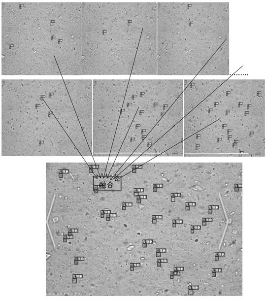 Body fluid microscopic video lean expression method based on image fusion