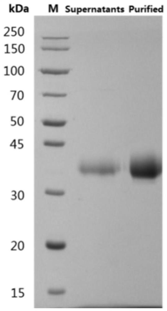 Neutralizing epitope peptide in RBD region of SARS-CoV-2 S protein and application of neutralizing epitope peptide