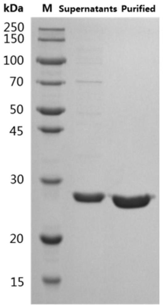 Neutralizing epitope peptide in RBD region of SARS-CoV-2 S protein and application of neutralizing epitope peptide