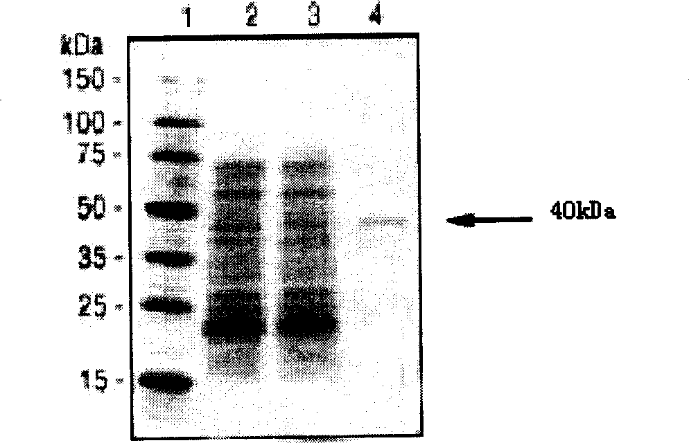 Clonorchis sinensis GTP bindin alpha subunit, its coded nucleic acid and its use