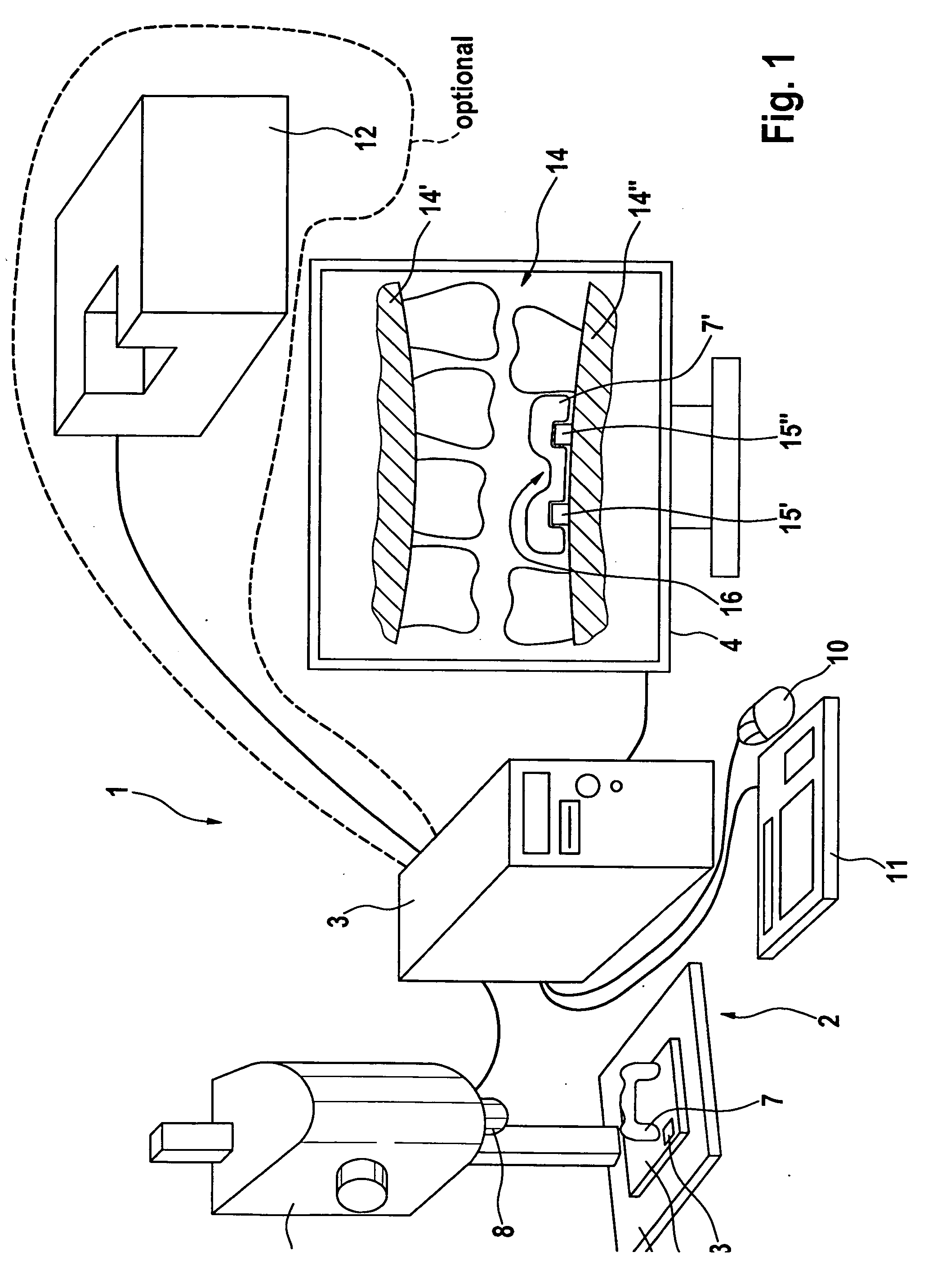 Method and Device for Producing Dental Prosthesis Elements