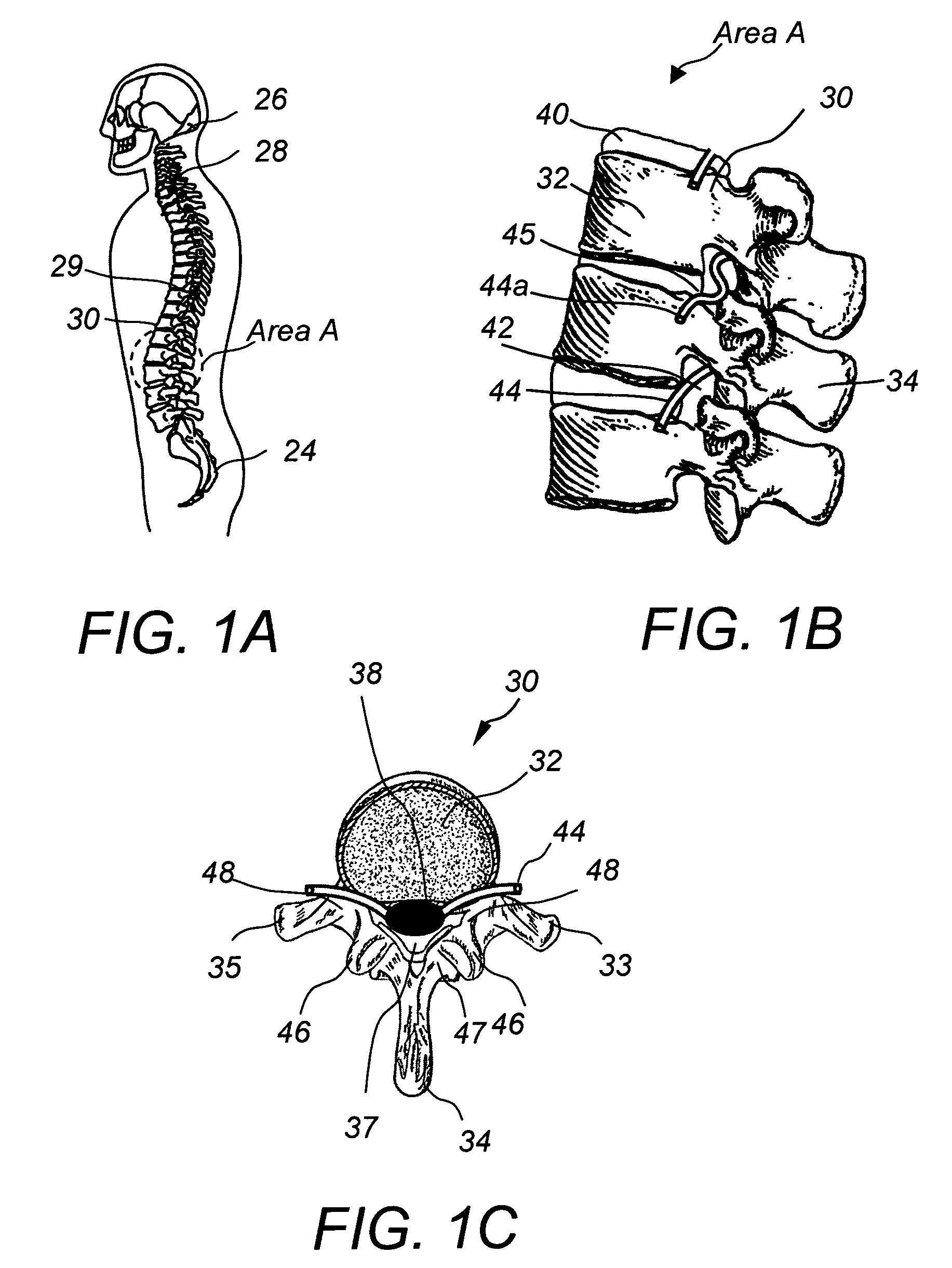 Apparatus and method for connecting spinal vertebrae