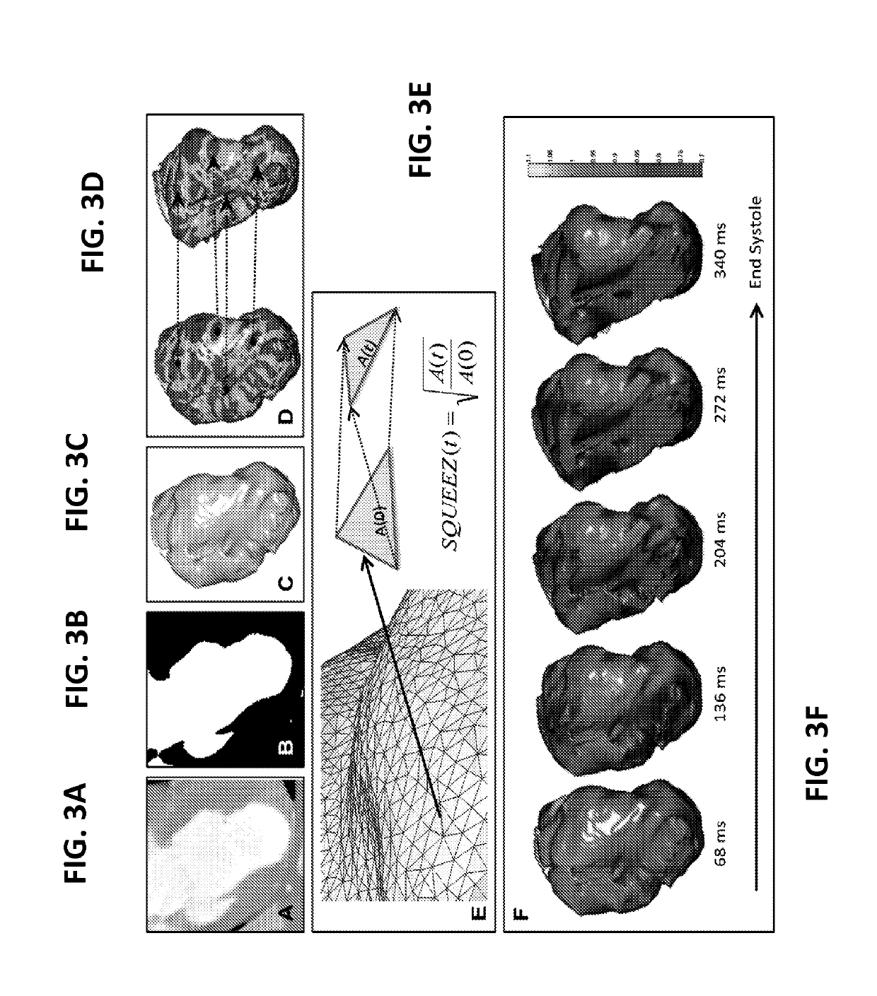 Methods for evaluating regional cardiac function and dyssynchrony from a dynamic imaging modality using endocardial motion