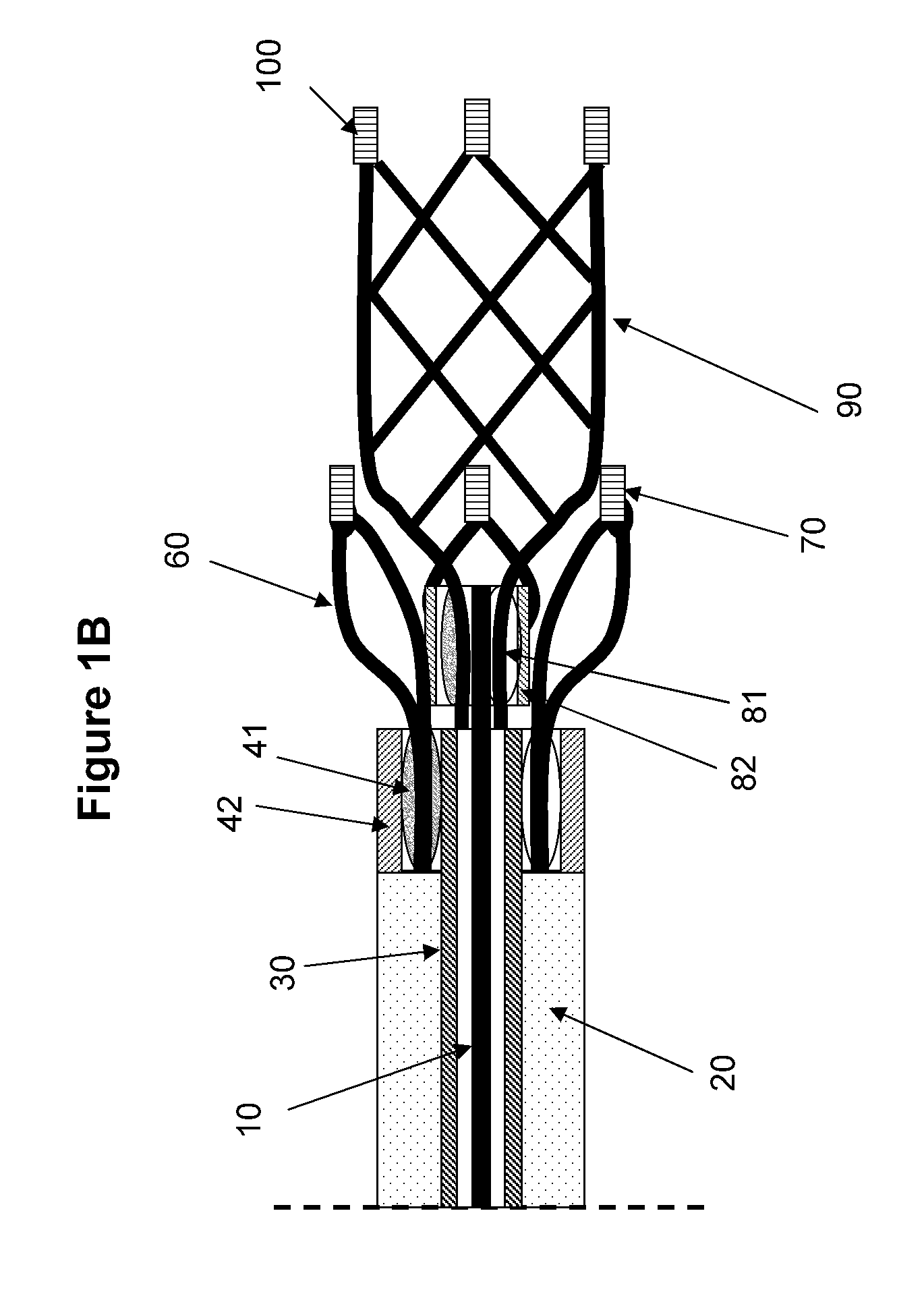 Intravascular thromboembolectomy device and method using the same
