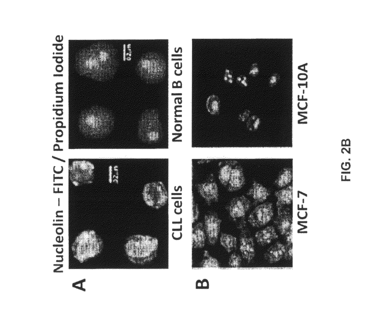 Human monoclonal antibodies to human nucleolin