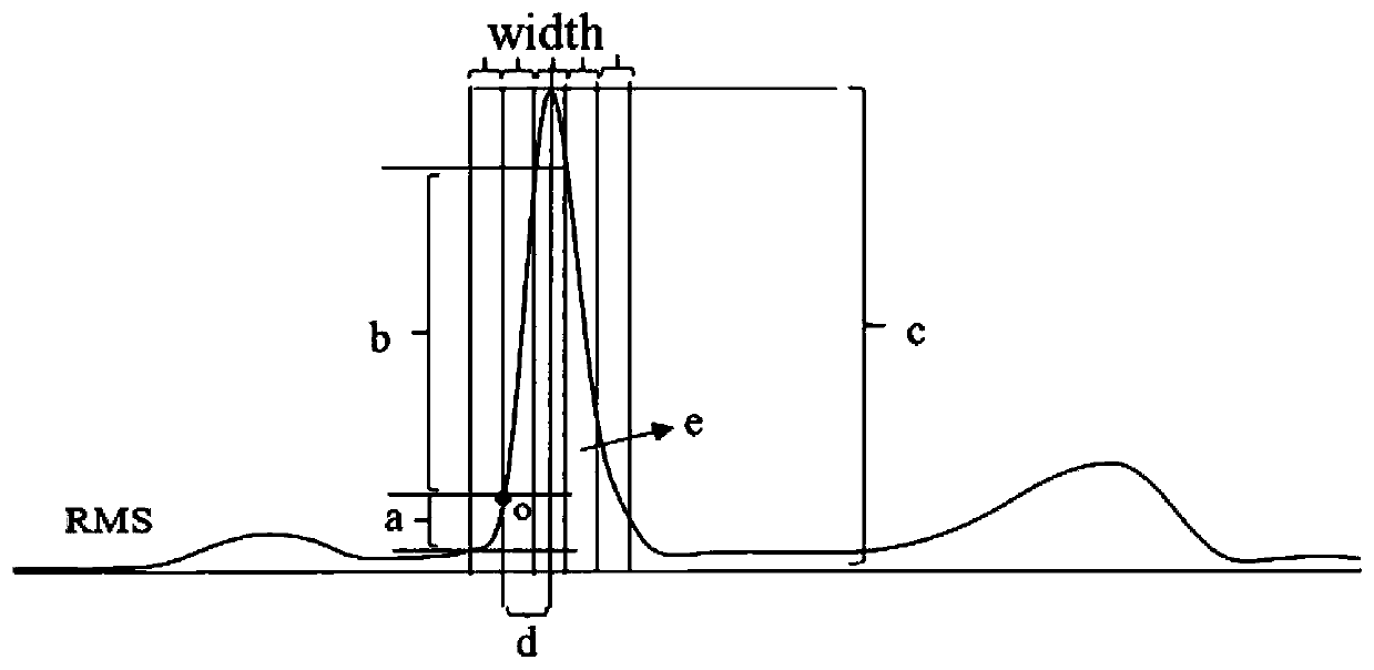 Method of detecting QRS complex start point in multi-lead electrocardiogram