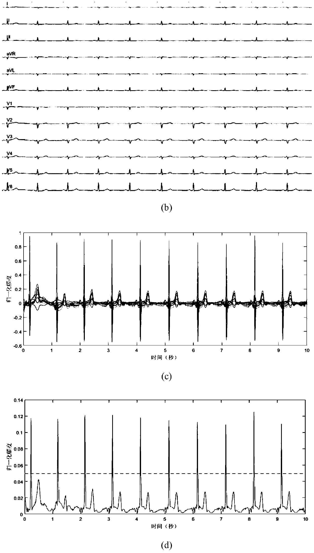 Method of detecting QRS complex start point in multi-lead electrocardiogram