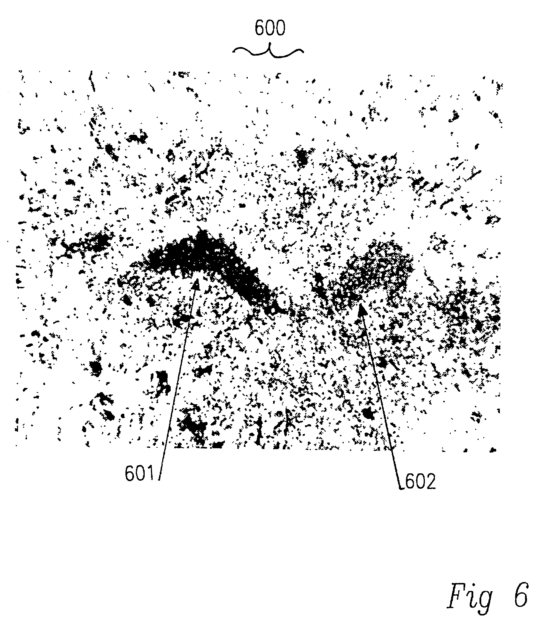 Composition and methods to improve neural outcome