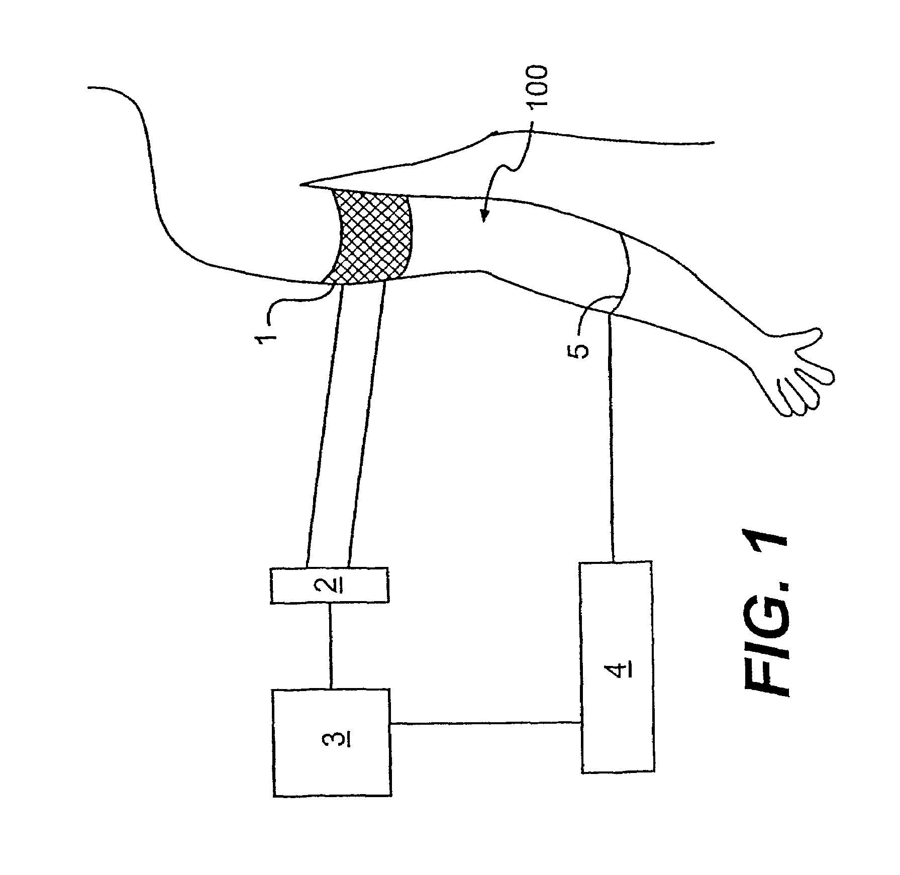 Methods for monitoring and optimizing central venous pressure and intravascular volume