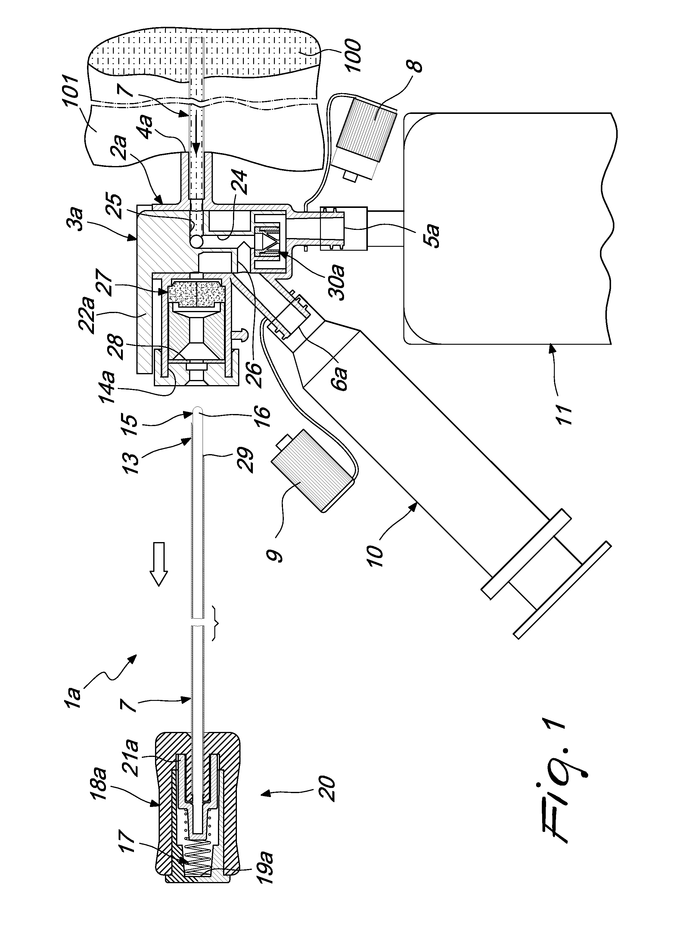 Medical device for applying catheters, particularly for thoracentesis procedures