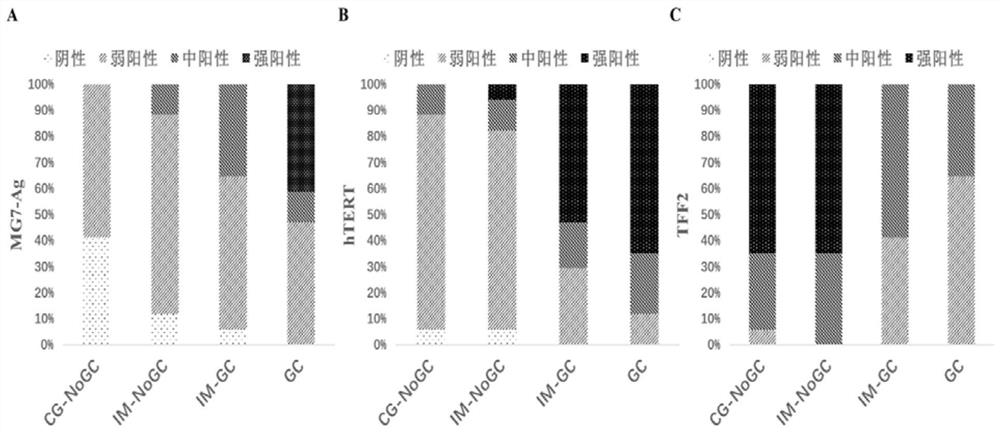 Application of MG7-Ag, hTERT and TFF2 expression analysis in intestinal metaplasia risk stratification and gastric cancer early warning