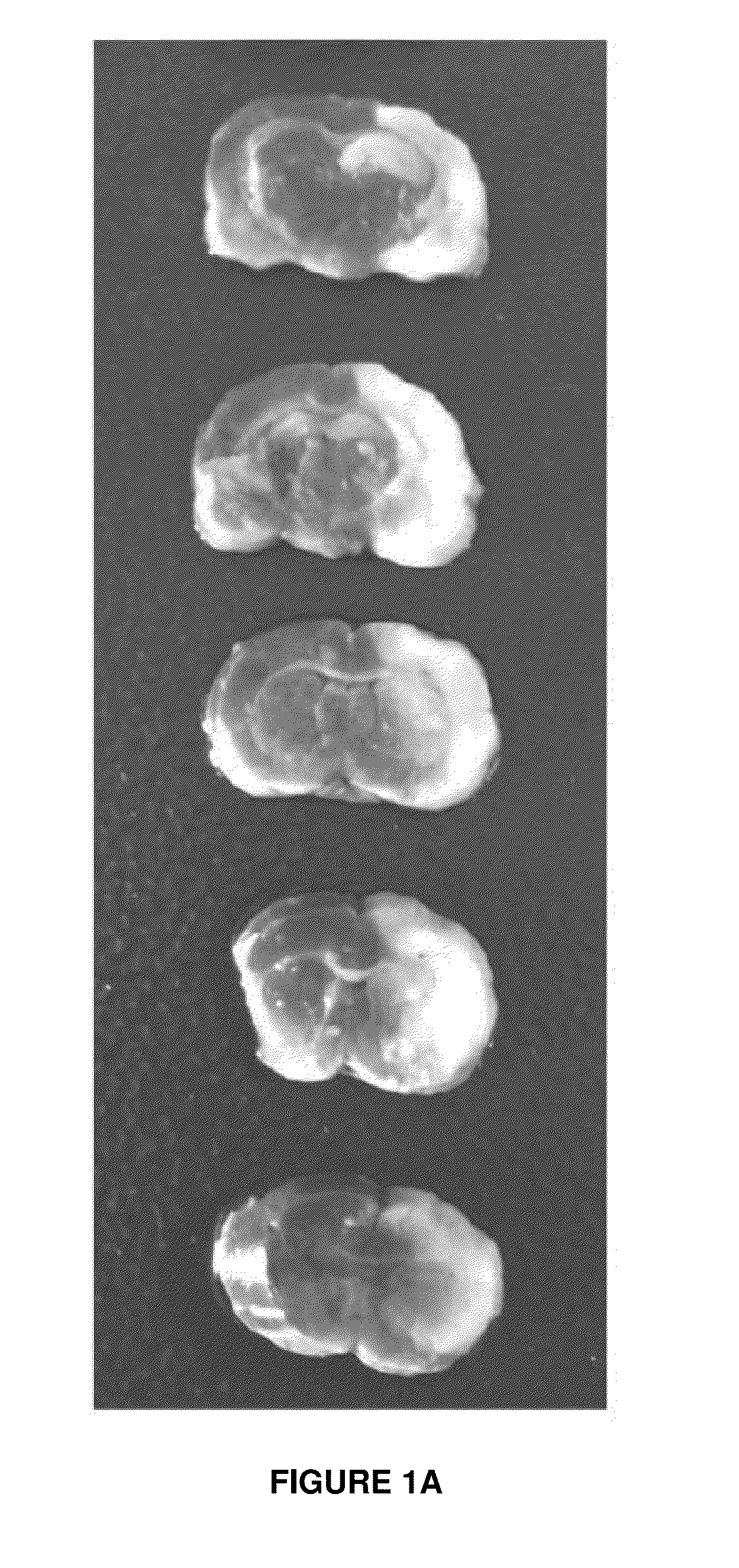 Pharmaceutical Compositions Containing Palmitoylethanolamide And Cytidine-Diphosphocholine And Methods Of Treatment Therewith