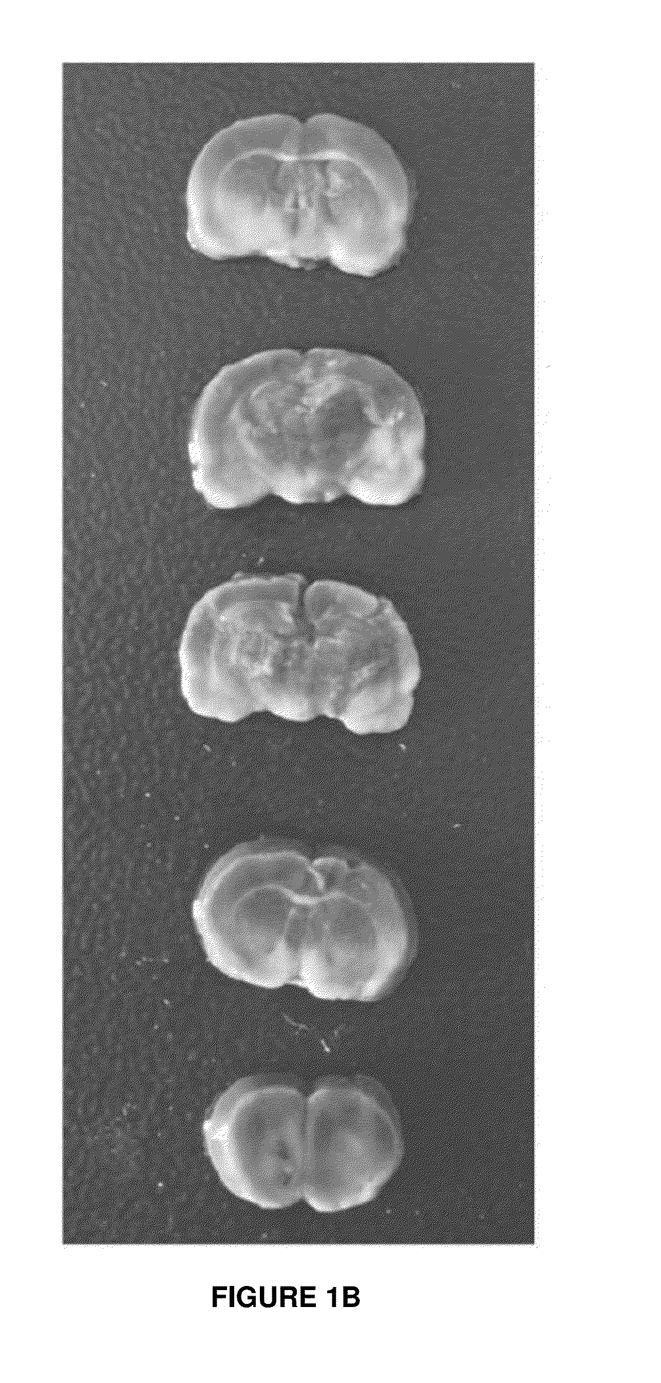 Pharmaceutical Compositions Containing Palmitoylethanolamide And Cytidine-Diphosphocholine And Methods Of Treatment Therewith