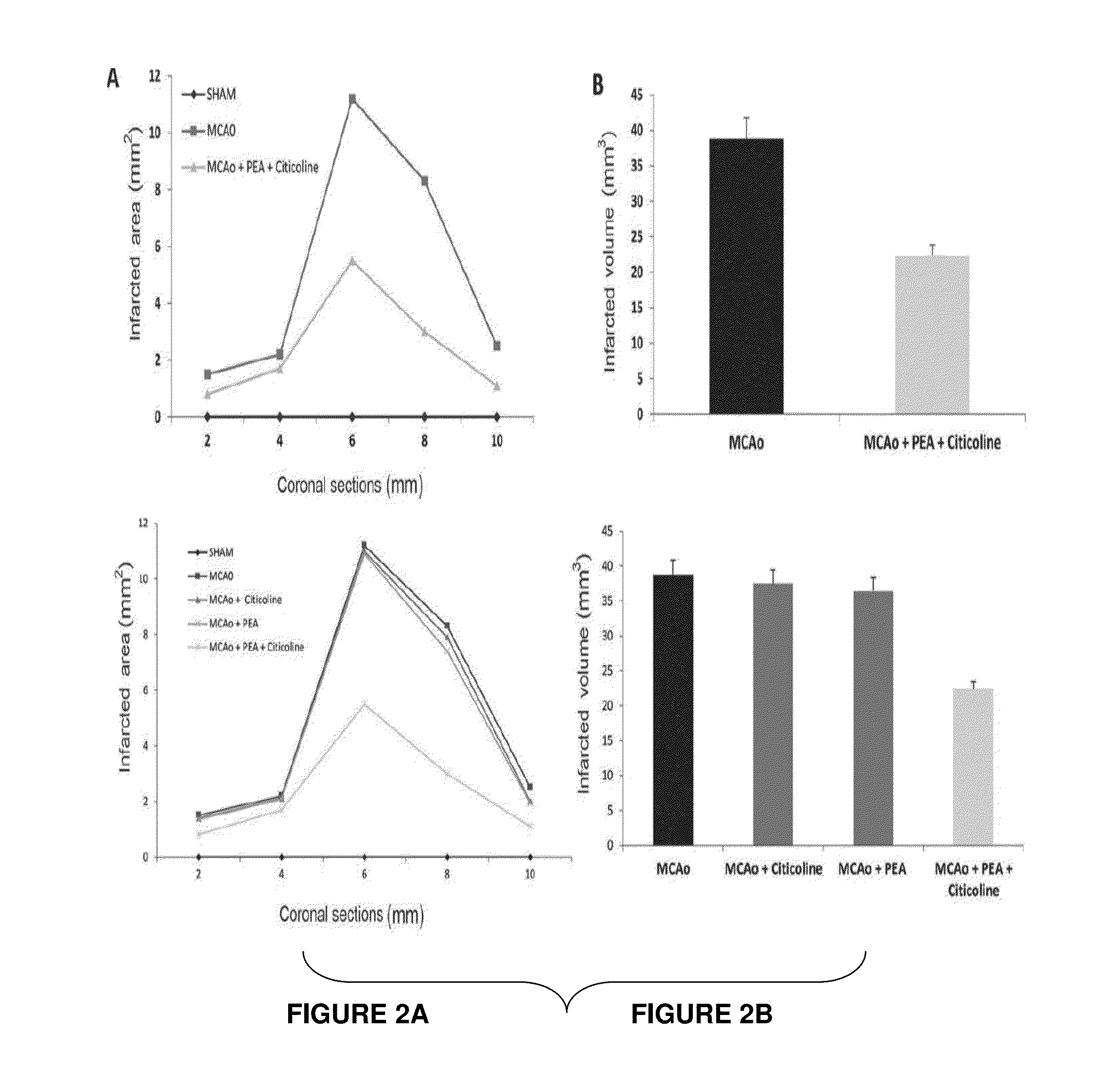 Pharmaceutical Compositions Containing Palmitoylethanolamide And Cytidine-Diphosphocholine And Methods Of Treatment Therewith