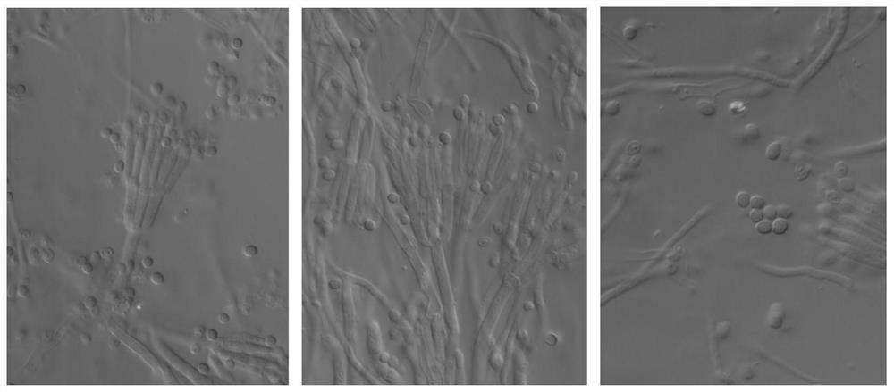 A kind of basket-shaped golden bacterium and its application