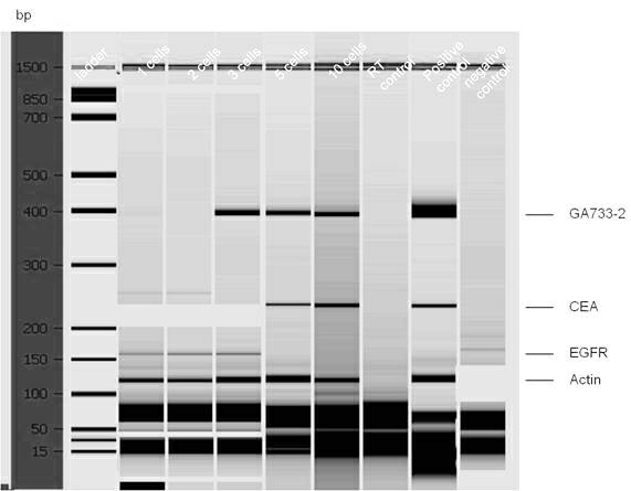 Kit for detecting free colorectal cancer cell markers in blood