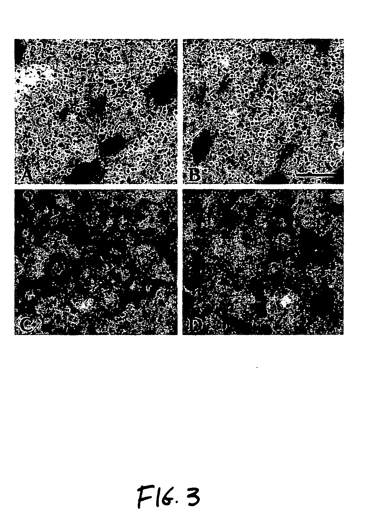 Method of ameliorating or abrogating the effects of a neurodegenerative disorder, such as Huntington's disease, by sodium butyrate chemotherapy