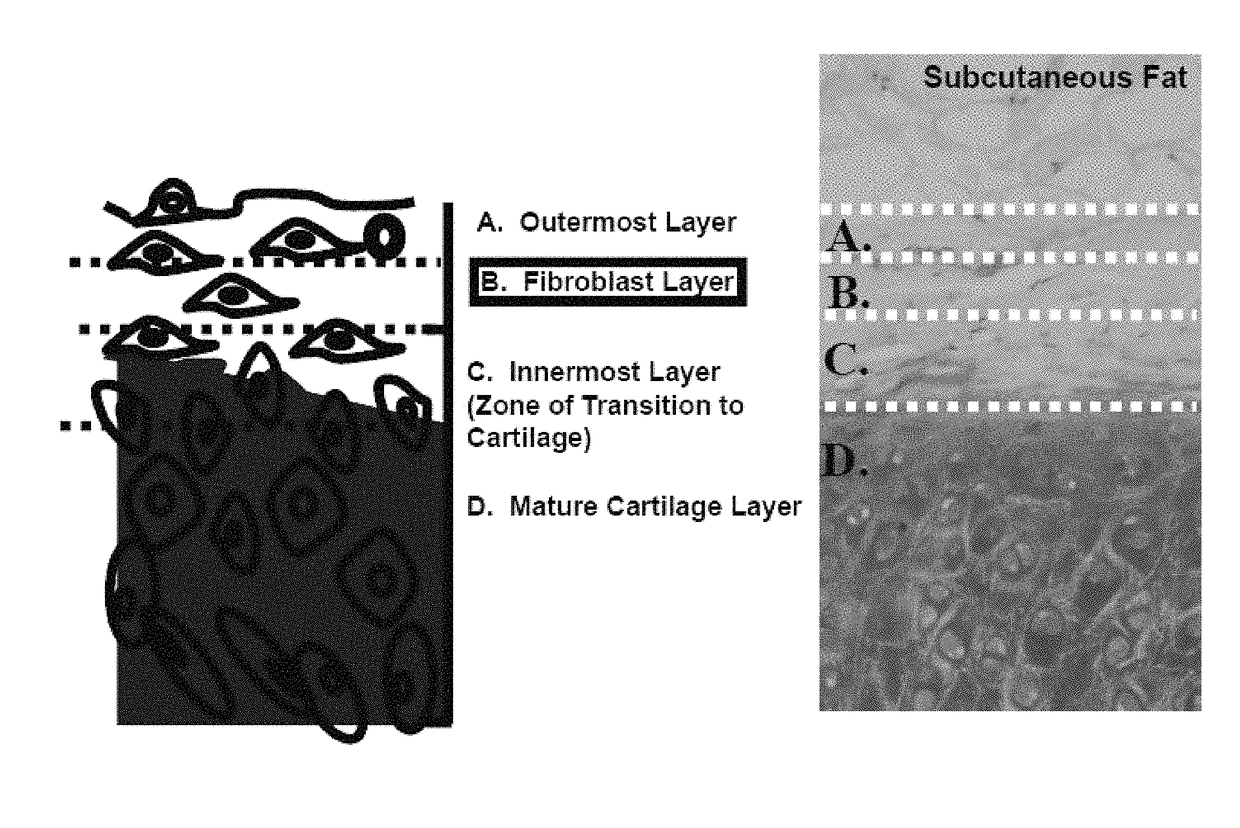 Method for preparation of cartilage cell