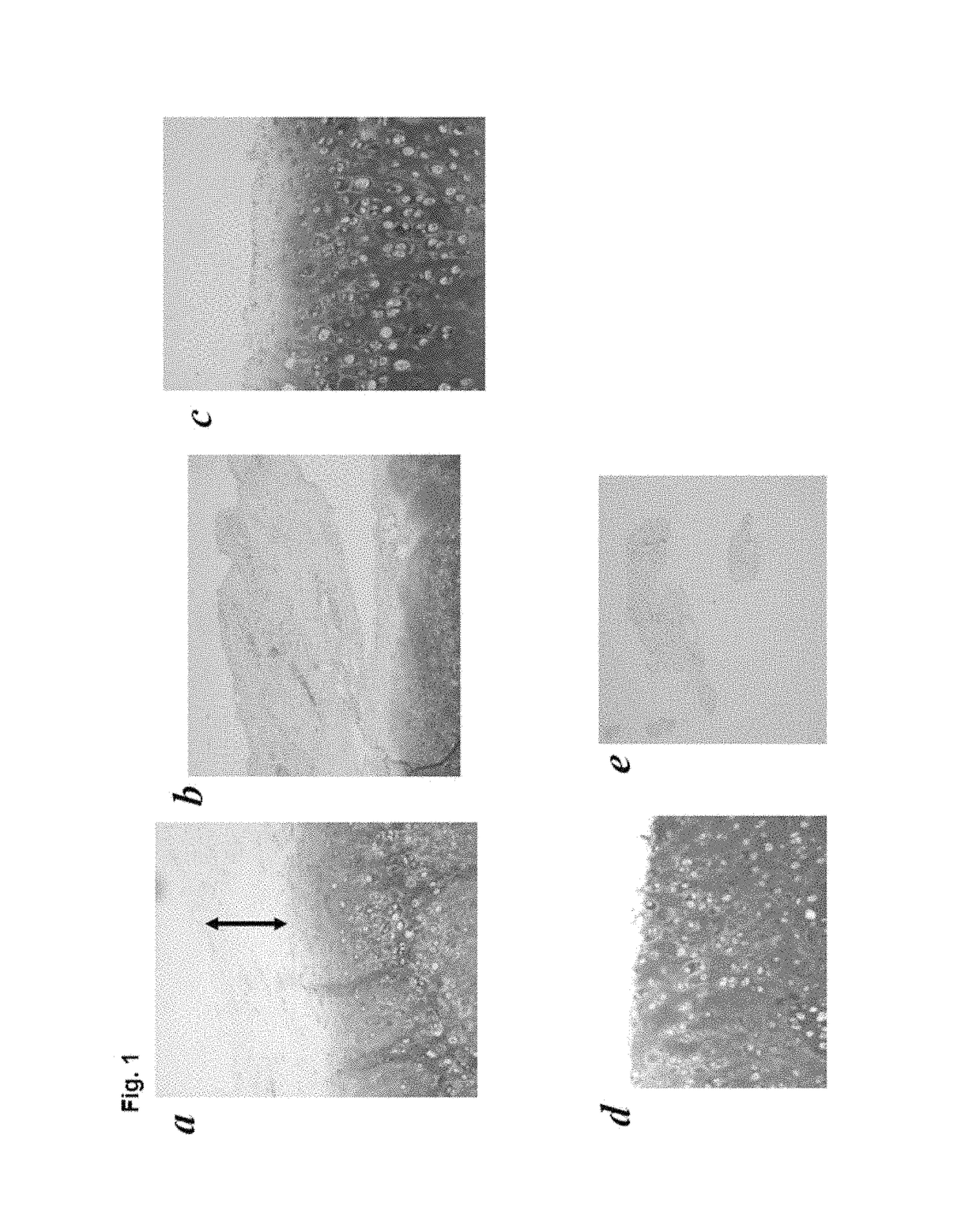 Method for preparation of cartilage cell