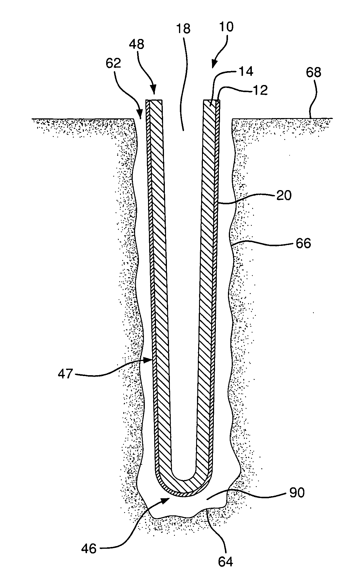 Tunnel dressing for use with negative pressure wound therapy system