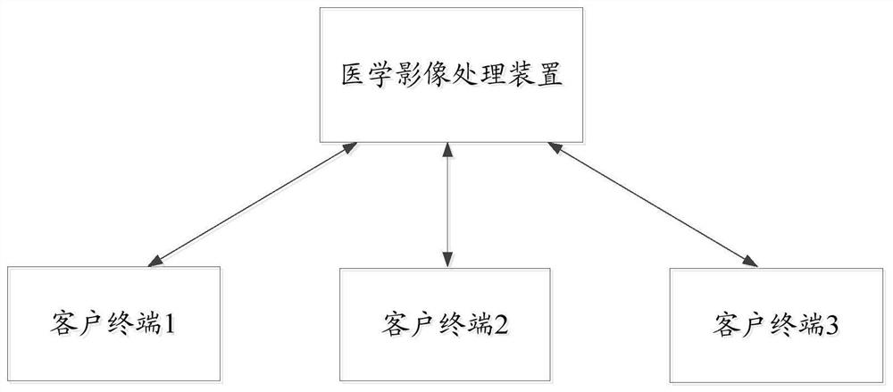 An image processing method and related equipment