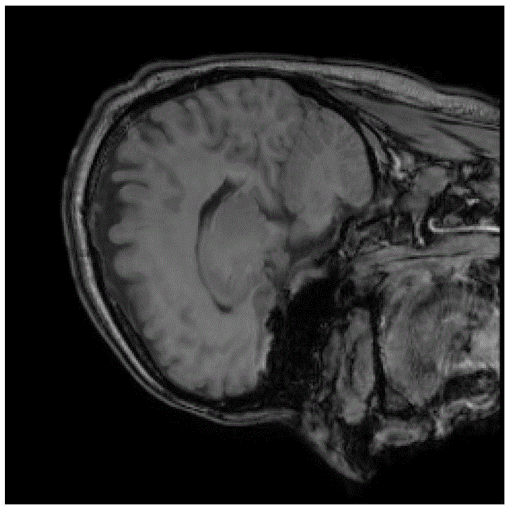 Compressive Sensing MRI Image Reconstruction Method Based on Low Rank Sparse Structure