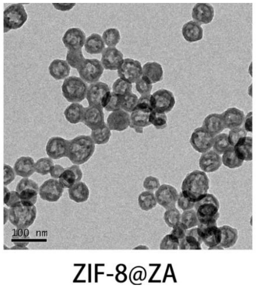 Preparation method of zoledronic acid-loaded zeolitic imidazolate framework nanoparticle material