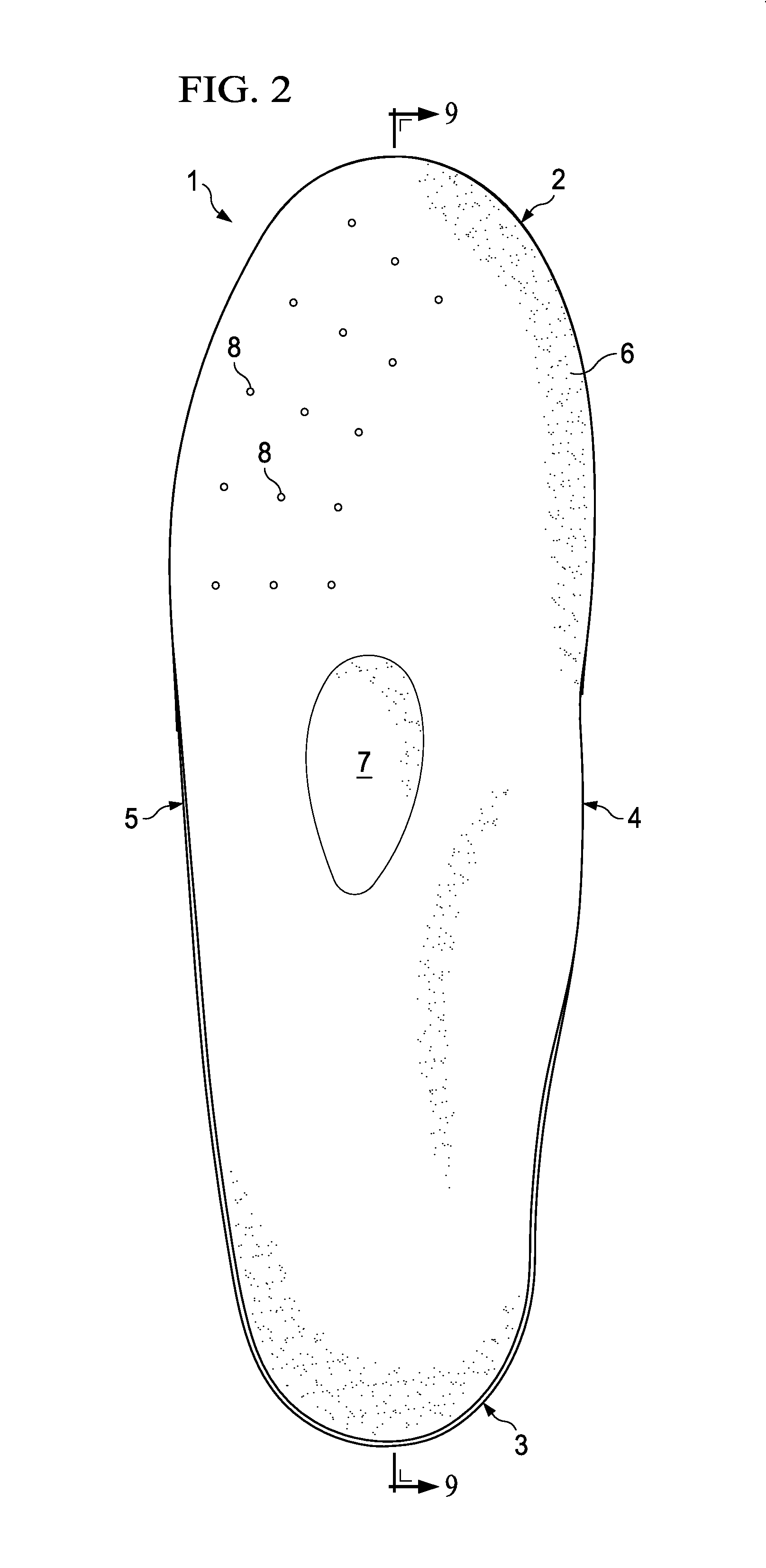 Insole for Relief of Over-Pronation and Knee Joint Stress