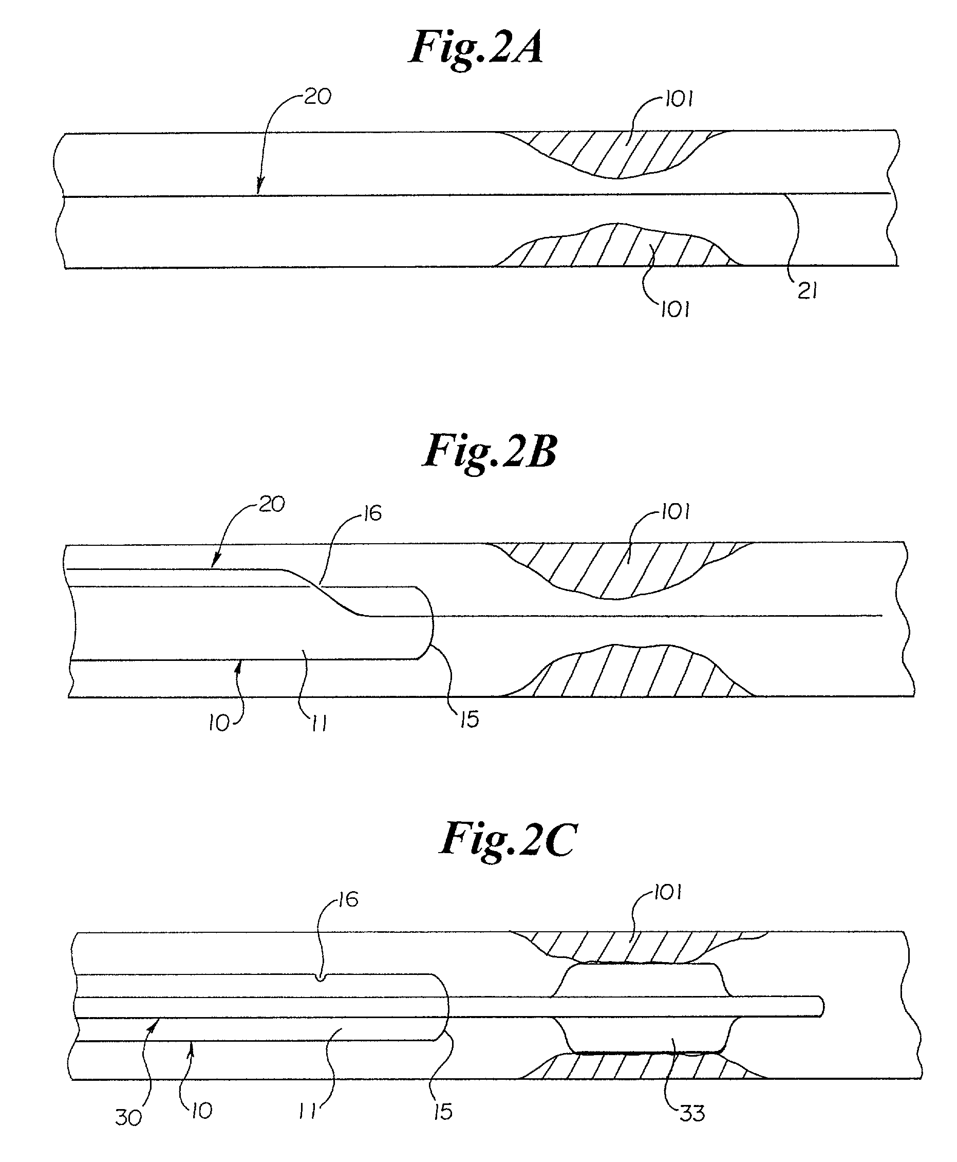 Rapid exchange sheath for deployment of medical devices and methods of use