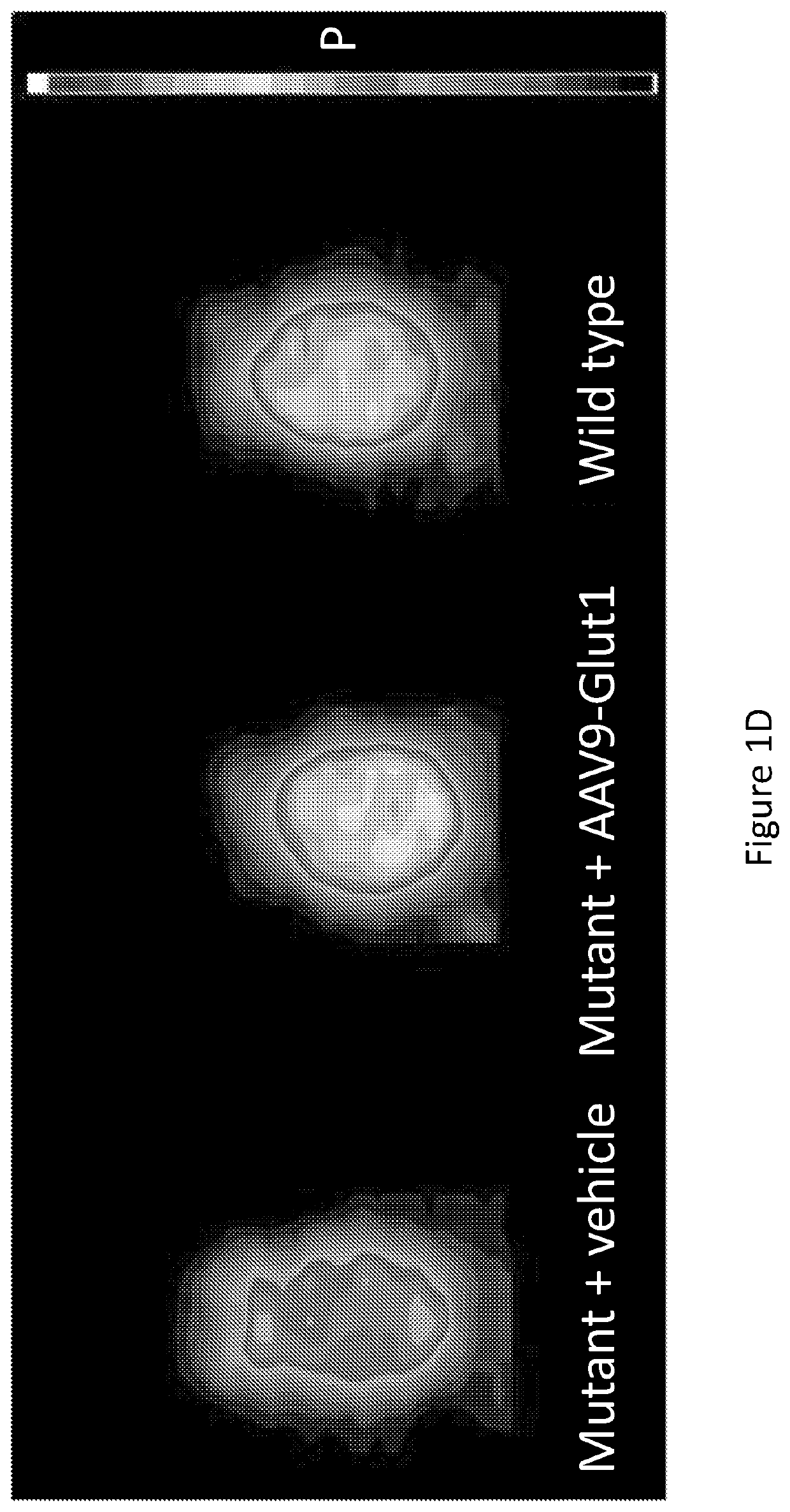 Slc2a1 lncrna as a biologic and related treatments and methods