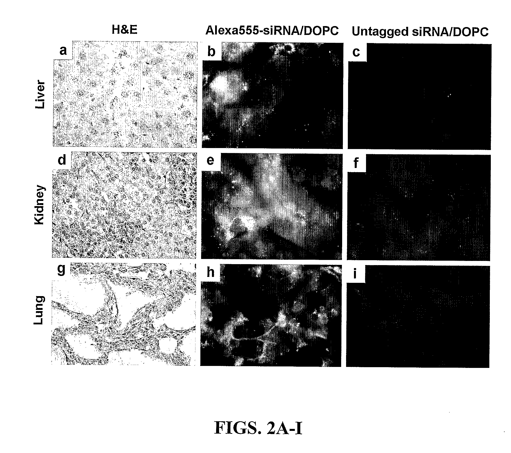 Delivery of Sirna by Neutral Lipid Compositions