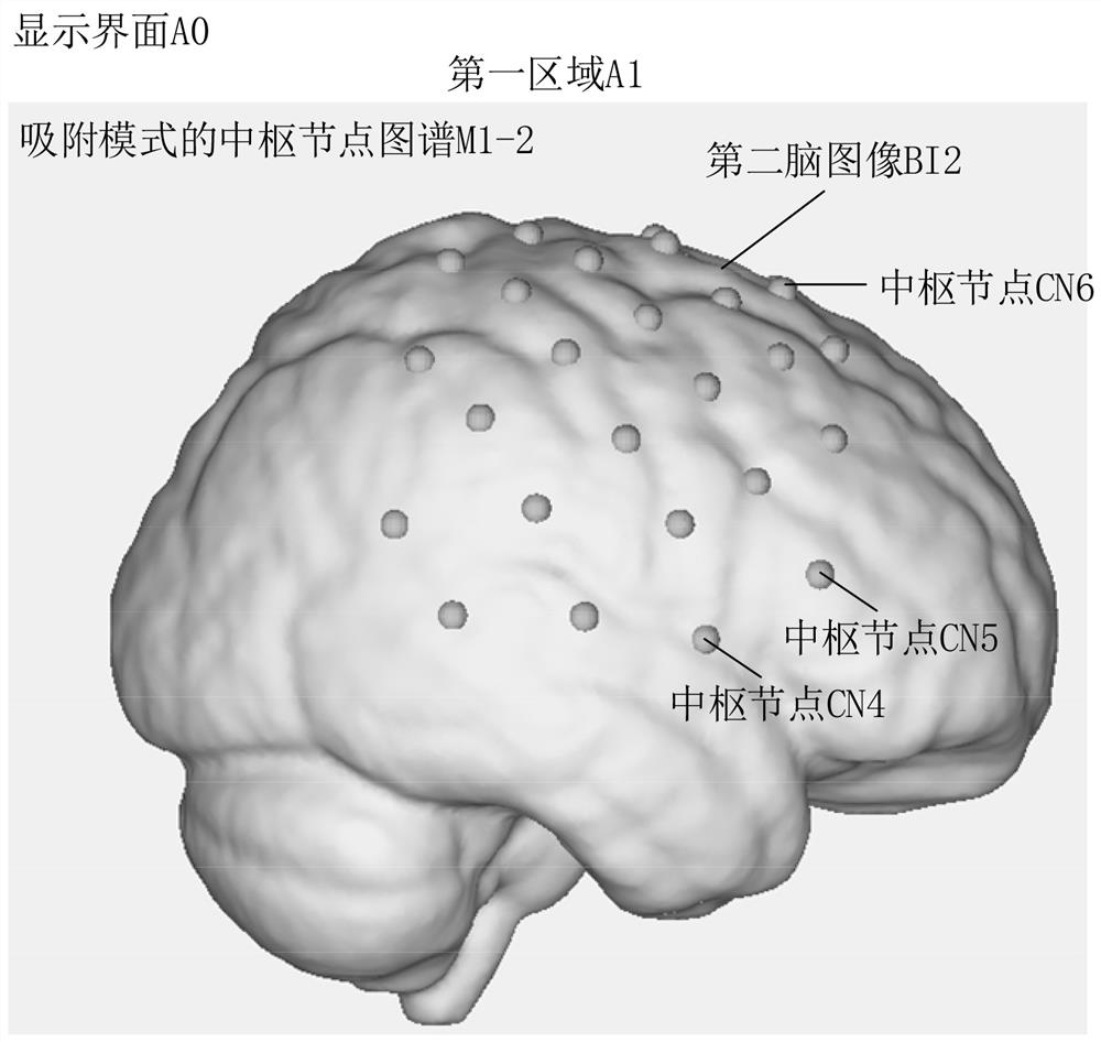 Auxiliary analysis method, device, system and storage medium for brain injury