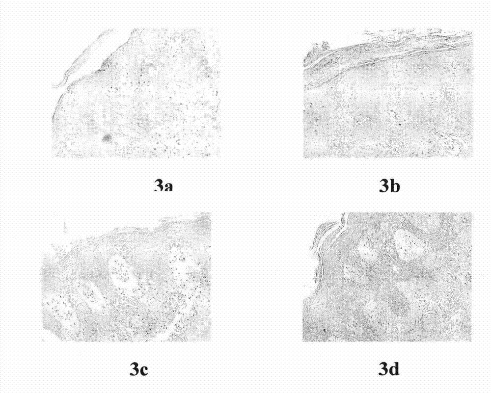 Method for building psoriasis basic research models, and gas-liquid level transmembrane device