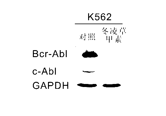 Target degradation Bcr-Abl protein reagent and application of target degradation Bcr-Abl protein reagent in preparing Philadelphia chromosome positive tumor treatment medicine