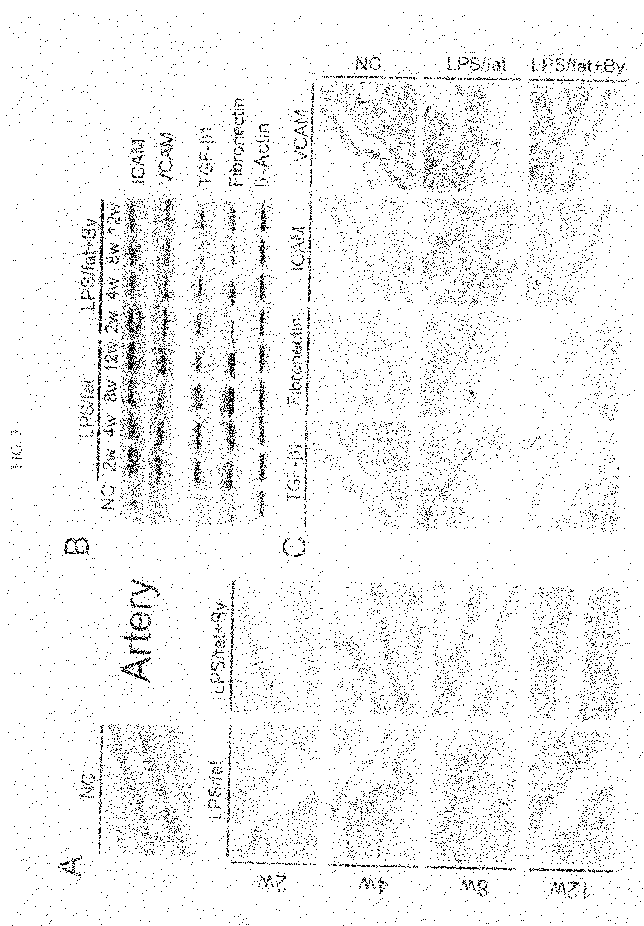 Composition comprising bee venom for the treatment of atherosclerosis