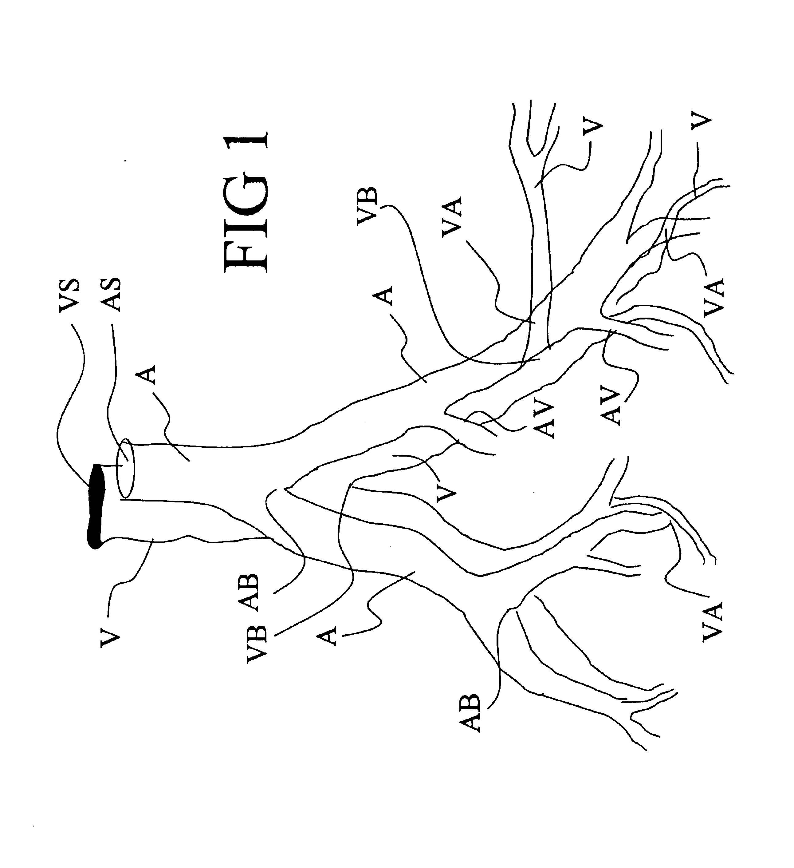 Angiography method and apparatus