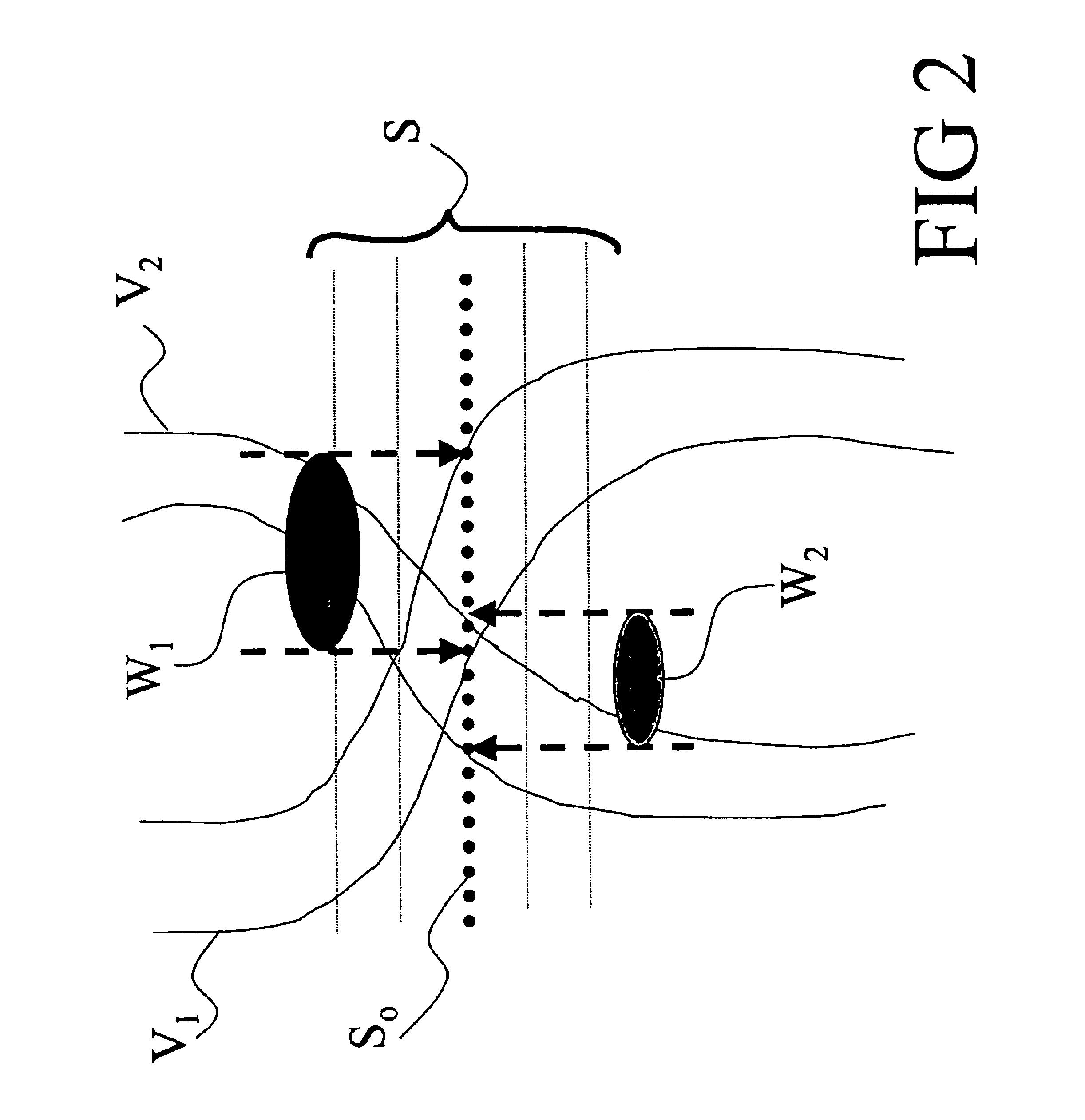 Angiography method and apparatus