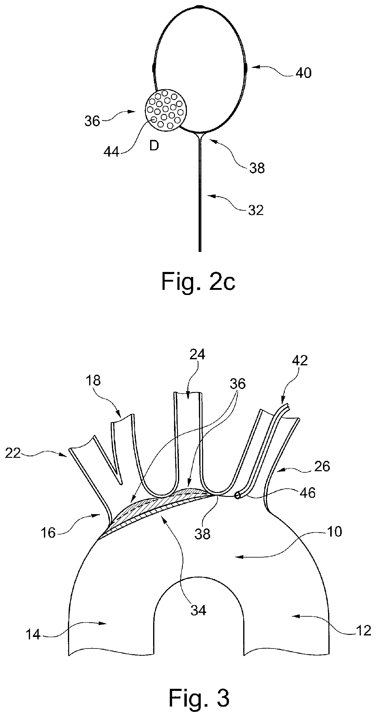 Medical device for embolic protection