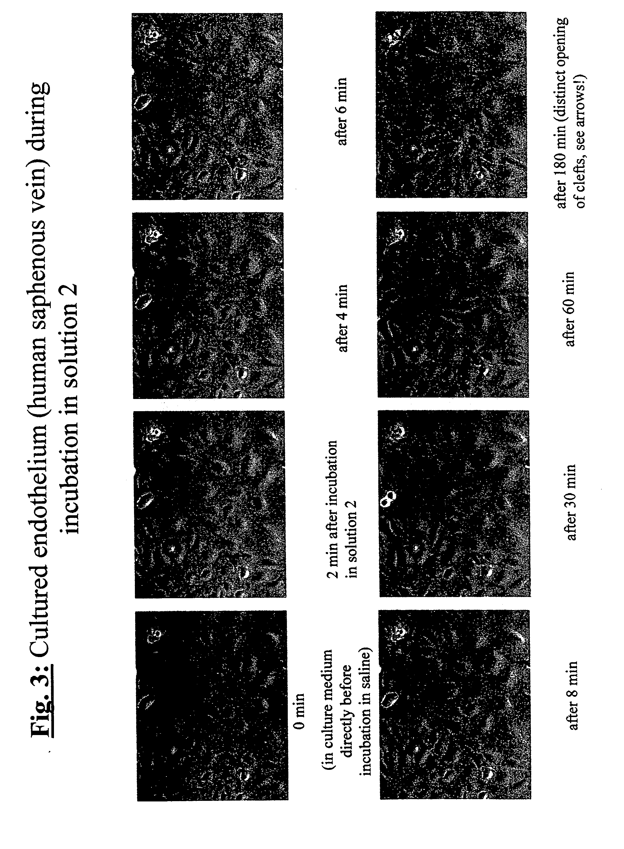 Methods And Apparatus For Preserving The Endothelium In Isolated Hollow Organs And Biological Vessels