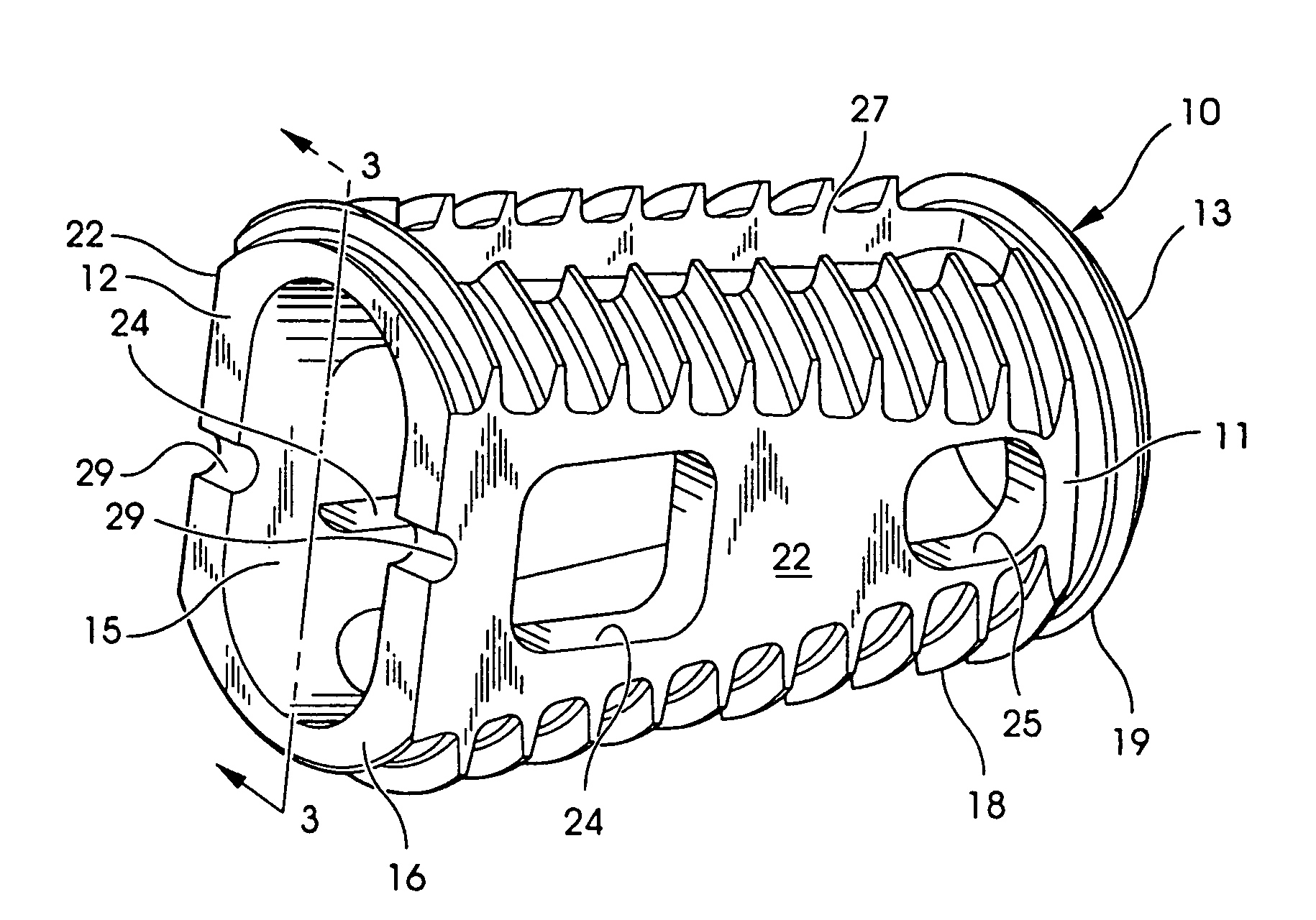 Interbody fusion device and method for restoration of normal spinal anatomy
