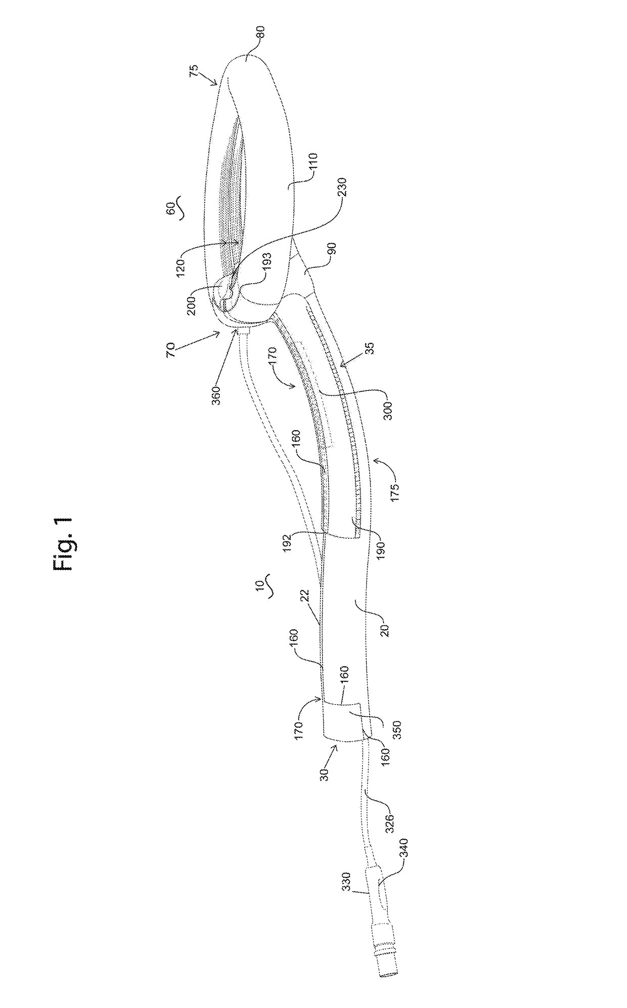 Easily removable intubating LMA