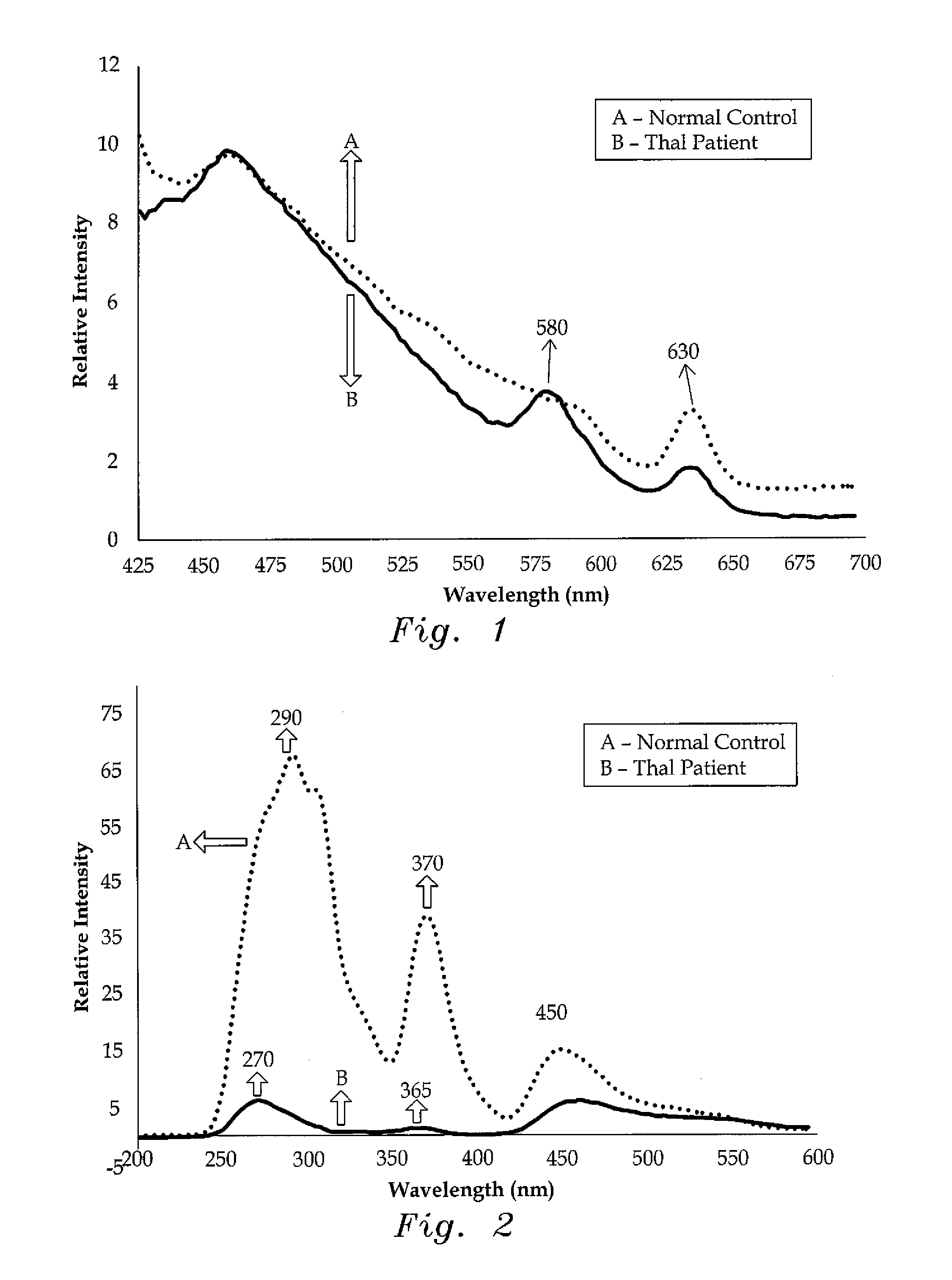 Method of detecting thalassemia by optical analysis of blood components