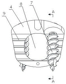 Anterior cervical spine zero-notch interbody fusion device