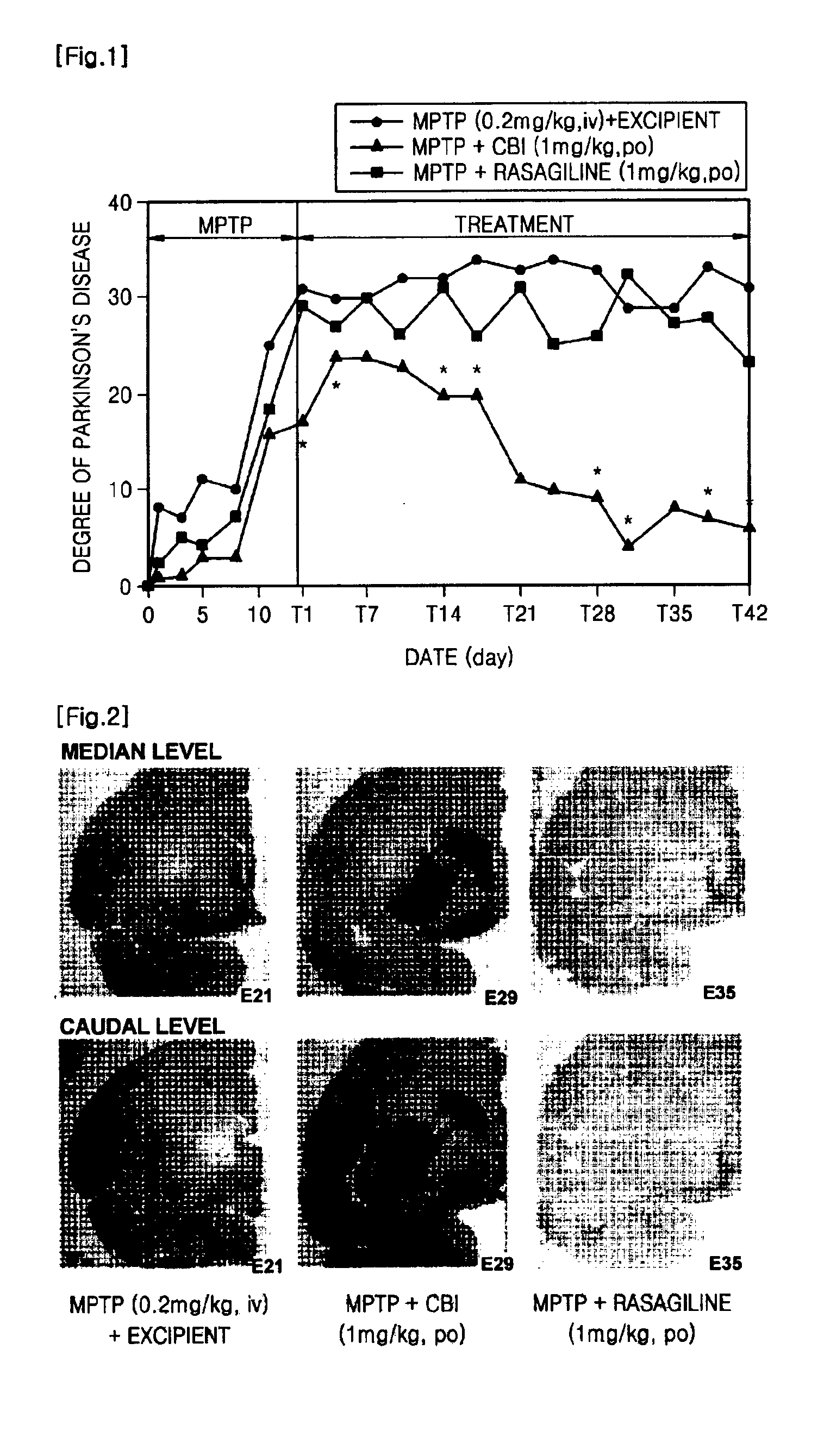 Pharmaceutical composition for inhibiting apoptosis of neuron or neurodegeneration