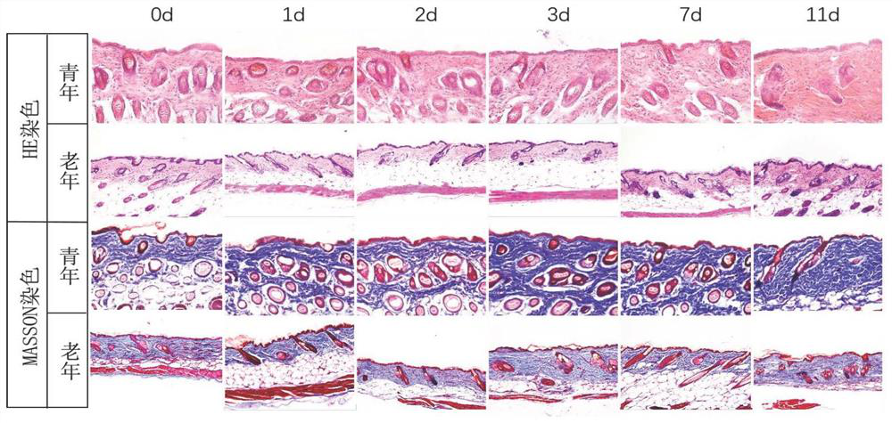 Application of colla corii asini in preparation of health-care product for promoting improvement of skin collagen