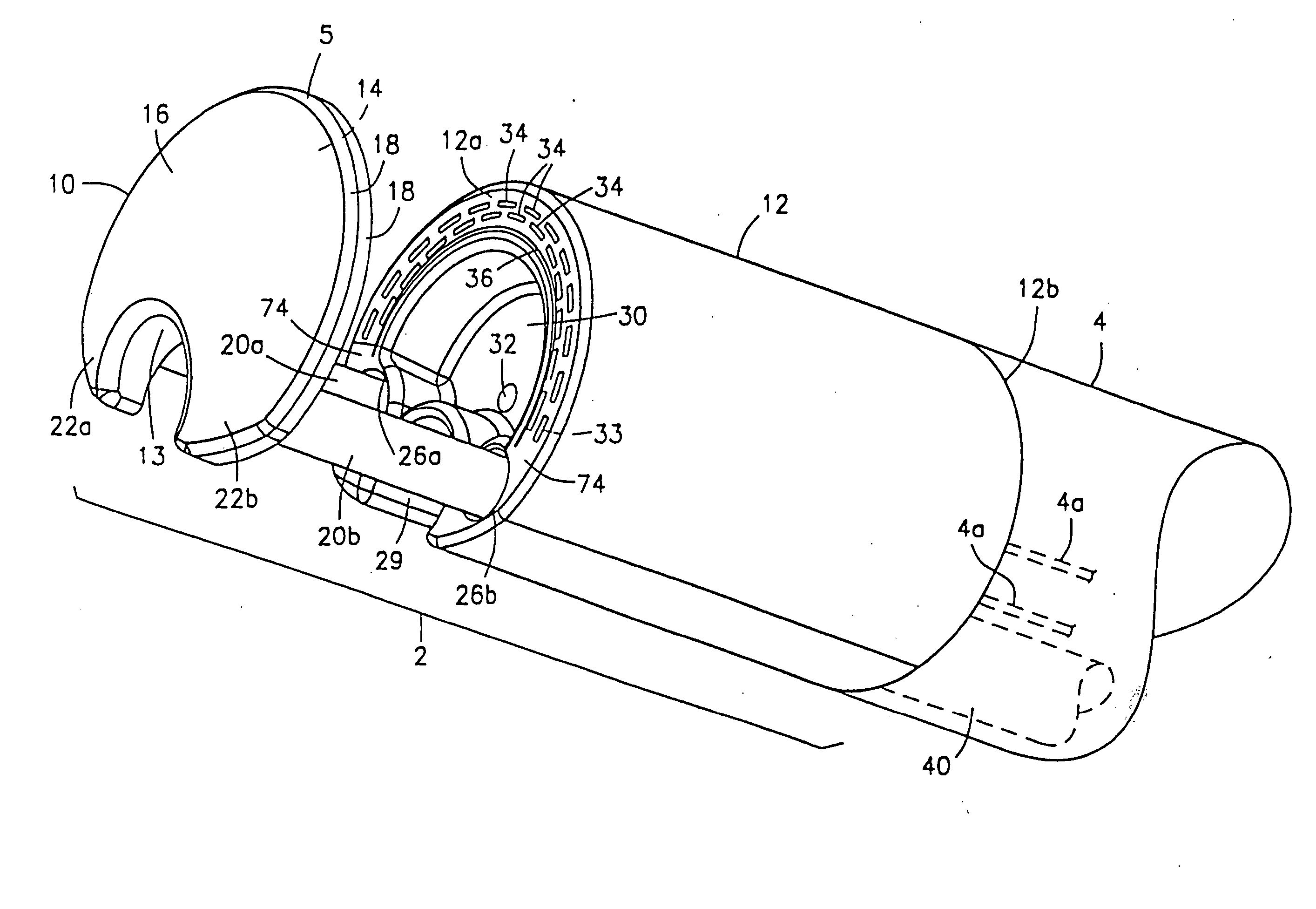 Method and device for full thickness resectioning of an organ