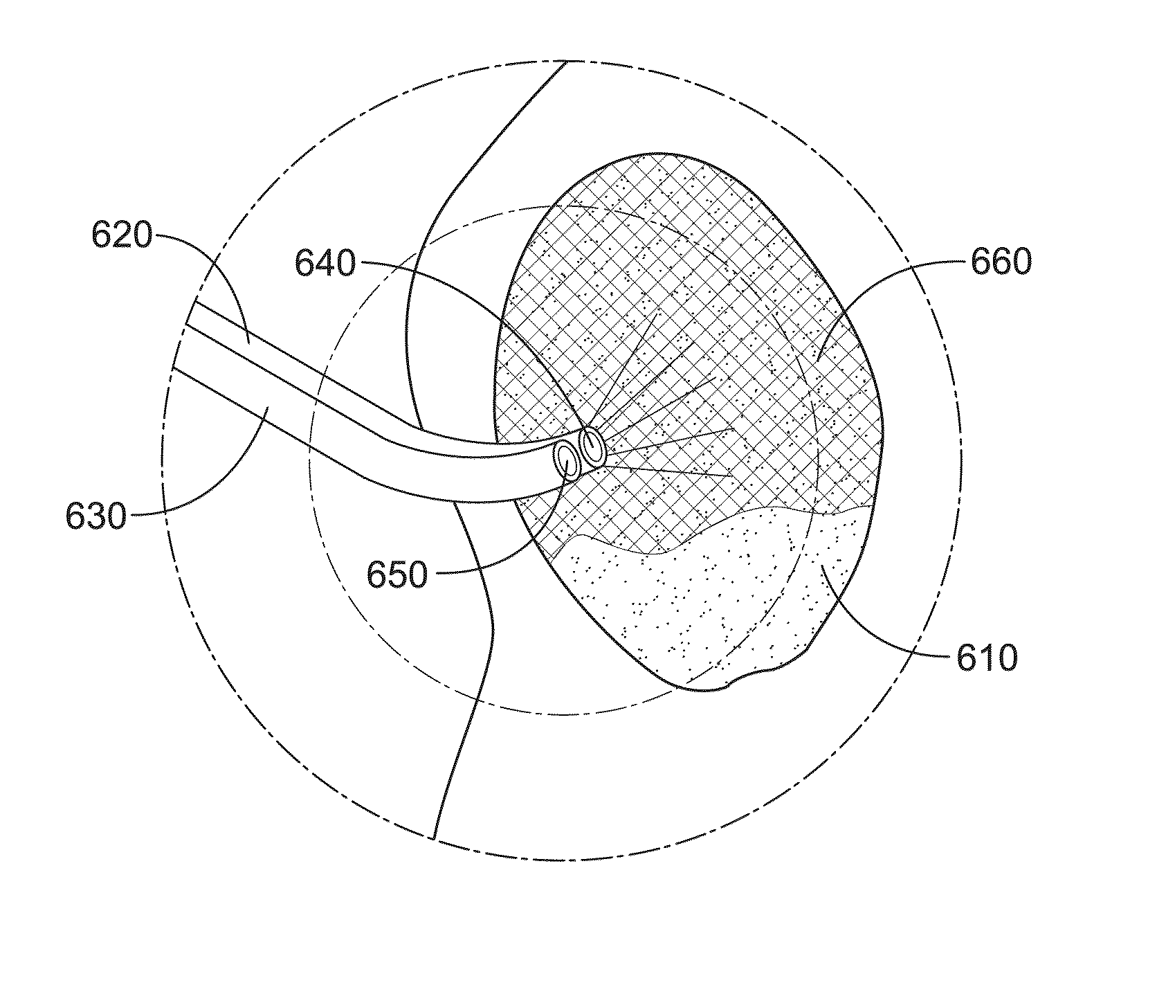 Mucosal tissue dressing and method of use