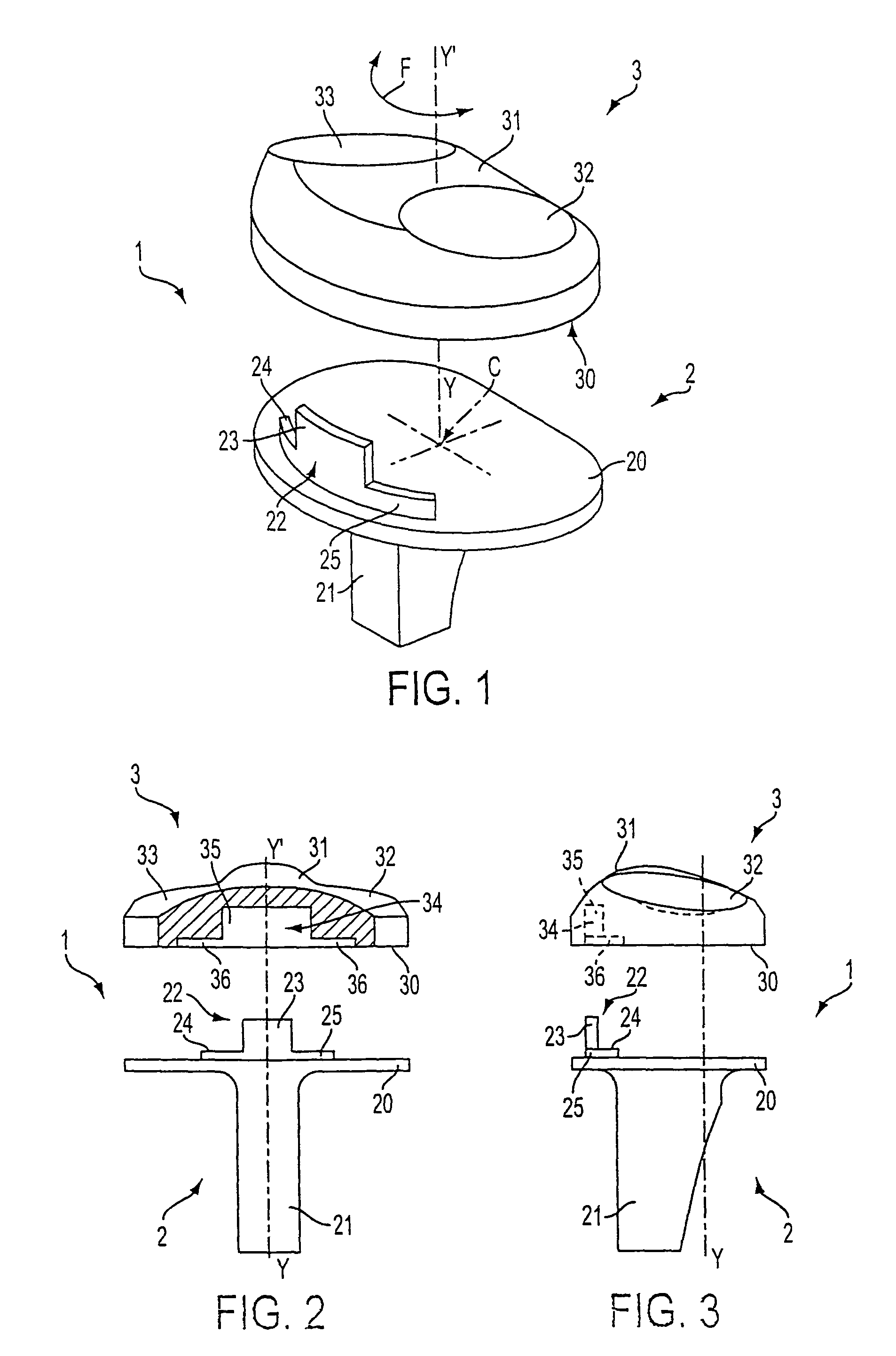 Knee prosthesis with a rotational plate