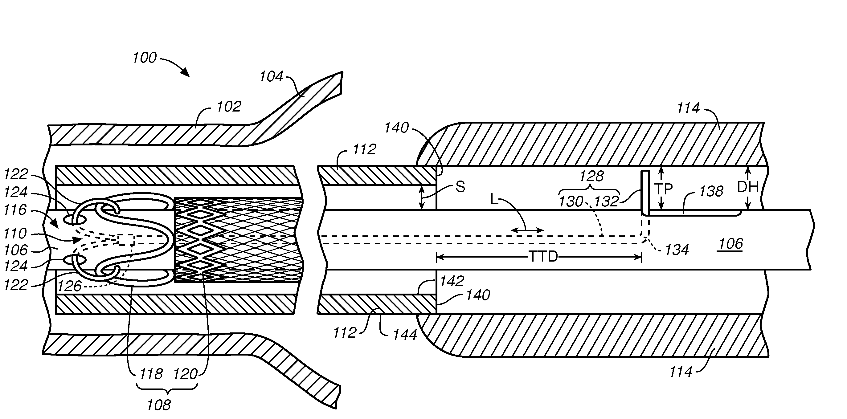 Stent-Graft Delivery System