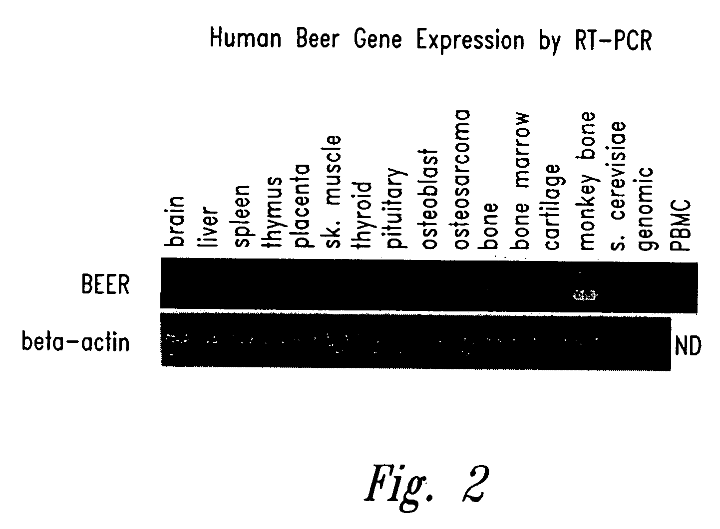 Compositions and methods for increasing bone mineralization